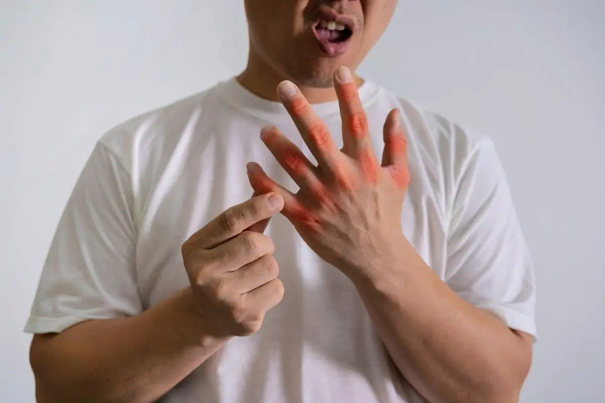 Homem com dores nas articulações dos dedos devido ao ácido úrico.
